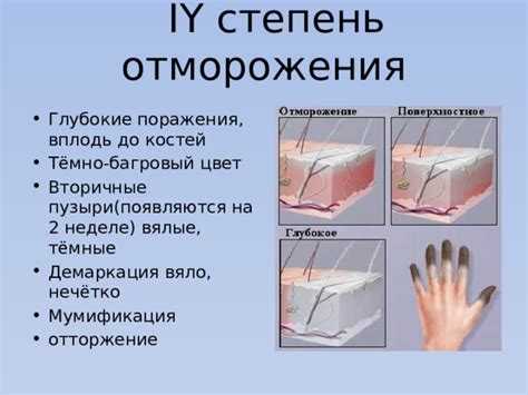 Последствия переохлаждения организма