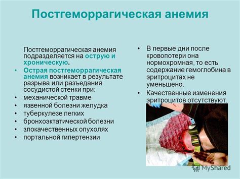 Постгеморрагическая анемия