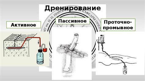 Предотвращение забивания дренажей