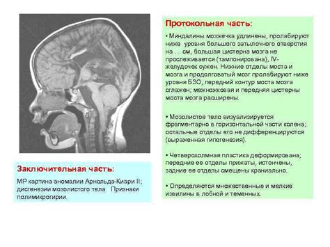 Предупреждение гипоплазии