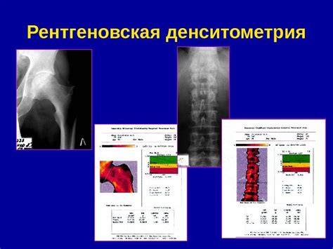 Преимущества клиник, специализирующихся на изучении плотности костей в Рязани