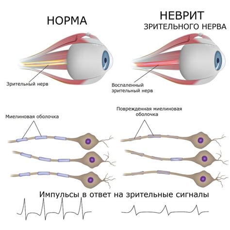 Принципы функционирования оптического нерва в аспекте визуальной связи