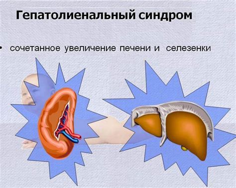 Причины гепаторенального синдрома