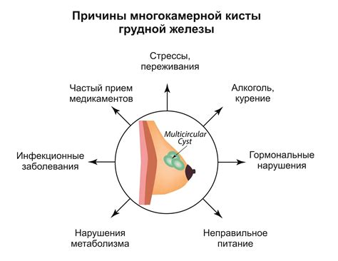 Причины гипоплазии молочной железы