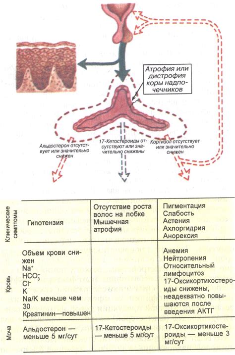 Причины гипофункции коры надпочечников: