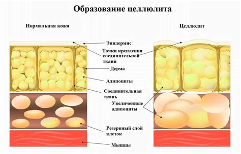 Причины появления гипоэхогенного участка