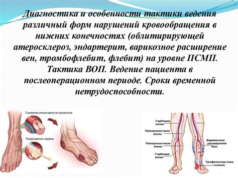 Проблема недостаточного кровообращения в нижних конечностях