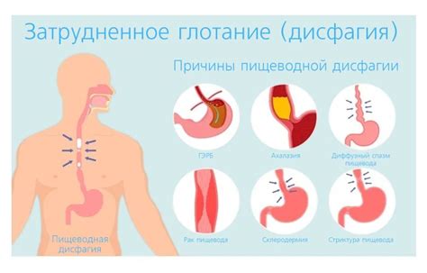 Профилактика загрубения пищевода при нарушении движения пищи