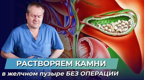 Профилактика образования камней с помощью десерта из плодов пальмы