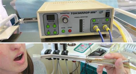 Процедура терапии звуком для миндалин на специальном медицинском оборудовании