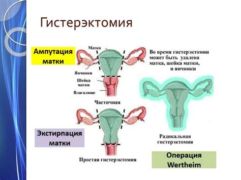 Разнообразные методы медицинского удаления обоих яичников