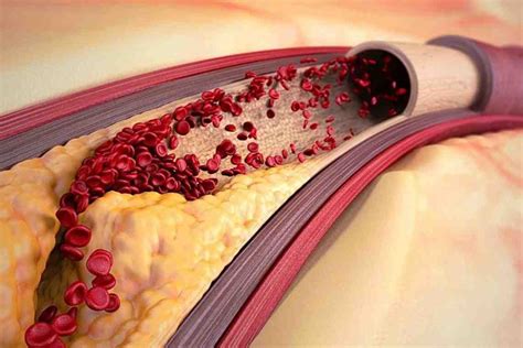Разрушительные последствия и причины образования отложений в сосудах