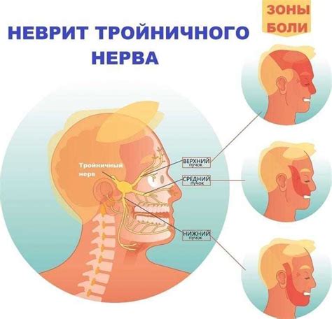 Реакции и воспаление тройничного нерва на лице: особенности и проявления