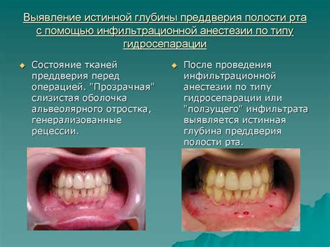 Риск повреждения полости рта при распространенной практике кормления костями