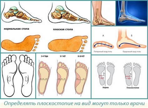 Ролевое значение комбинированной физической нагрузки в борьбе с прогрессированием плоскостопия