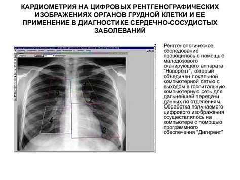 Роль КТ-с КУ в исследовании сердечно-сосудистой системы