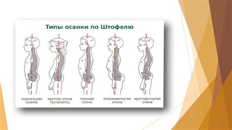 Роль малых суставных элементов в формировании правильной осанки