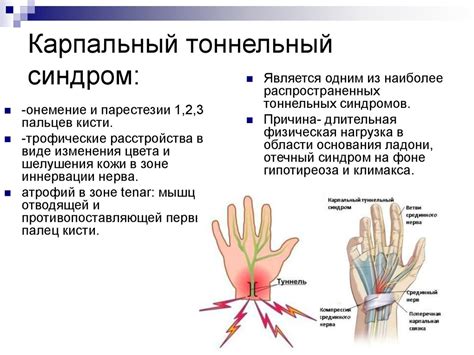 Роль медианного нерва в строении руки