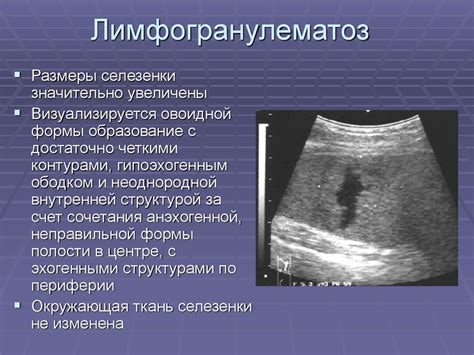 Роль паховых лимфоузлов в поддержании лимфодренажа и циркуляции