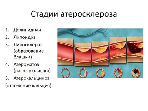 Роль увеличенной сердечной активности в процессе развития заболеваний сердечно-сосудистой системы