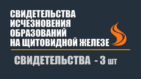 Свидетельства исчезновения Айнуры: показания и предположения