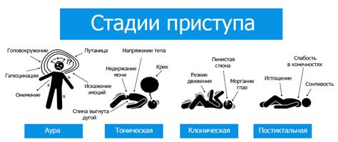 Симптомы абдукционного приступа и его проявления