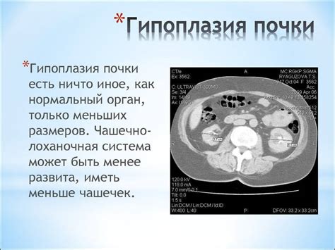 Симптомы гипоплазии