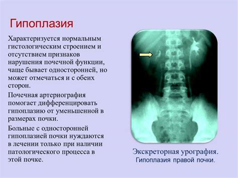 Симптомы гипоплазии копчика у ребенка