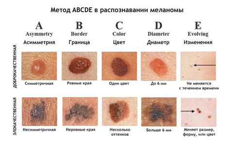 Симптомы и диагностика раздражения кожи