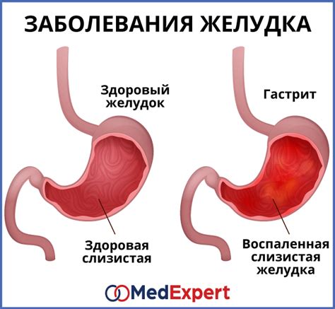 Симптомы и признаки нарушений в работе гипофиза