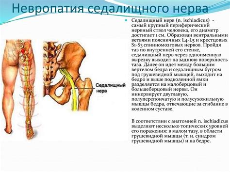 Симптомы и проявления при поражении большого седалищного нерва у представителей мужского пола