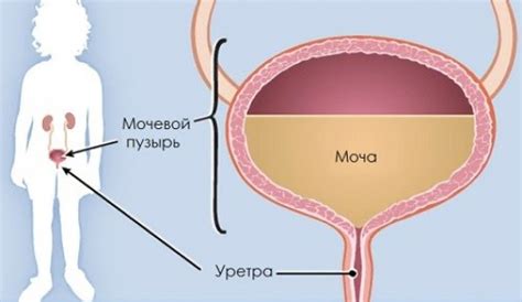 Симптомы ортопедического изгиба желчного мочевого пузыря