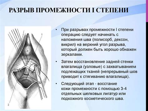 Симптомы разрыва шва в области промежности