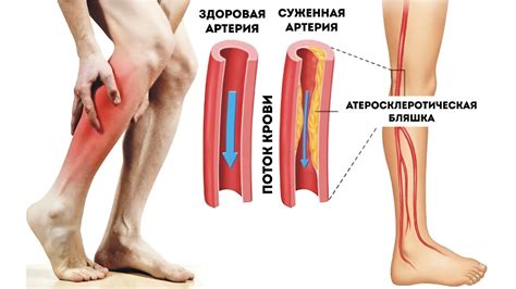 Советы для родителей: что делать при первых признаках гипотермии у ребенка