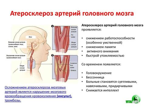 Современное состояние проблем с кровоносными сосудами головы и основные факторы их возникновения