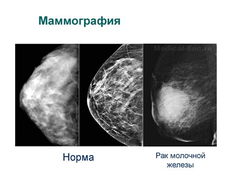 Специализация врача - исследование и терапия заболеваний грудной железы