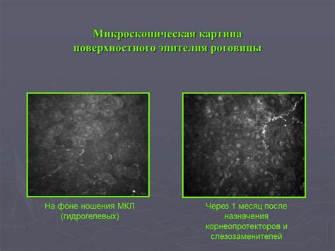 Спецификация линз: влияние различных материалов на терморегуляцию органа зрения