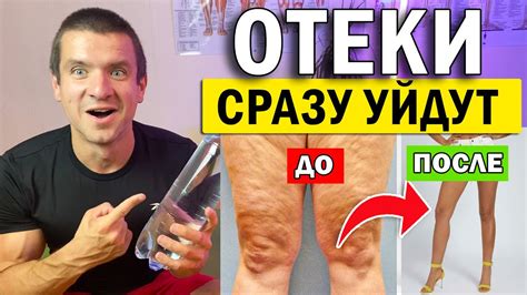 Способы снять отеки и усталость с ног: советы от знаменитостей