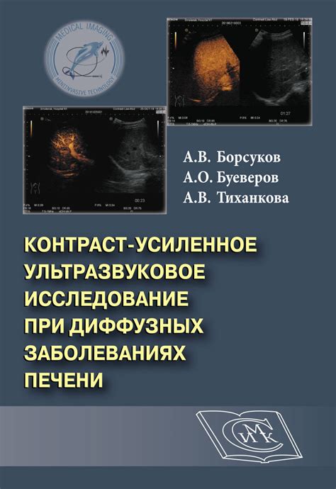 Ультразвуковое исследование при нарушении функции печени