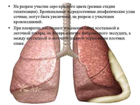 Уникальное действие Конкора на бронхиальные спазмы