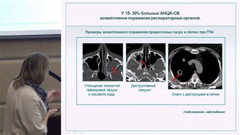 Уникальный механизм Сдэк Бекетова 35 и его особенности