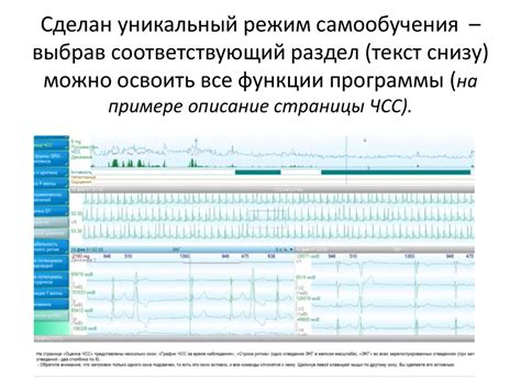 Уникальный раздел статьи: "Список стандартных отчетов"