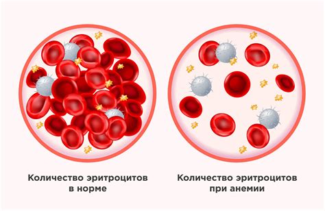 Уровень гемоглобина и его связь с риском развития анемии