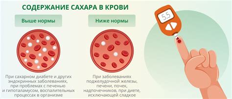 Уровень сахара в крови у пациентов с сахарным диабетом 2: что следует знать?