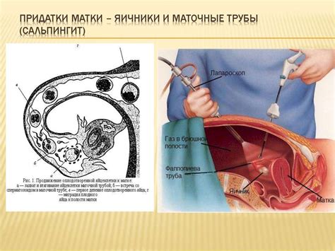 Факторы формирования жидкости в полости матки