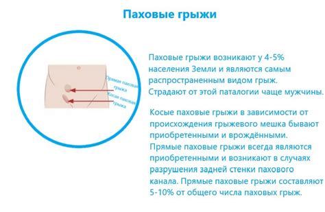 Физиологические аспекты уникальности паховой области у женщин