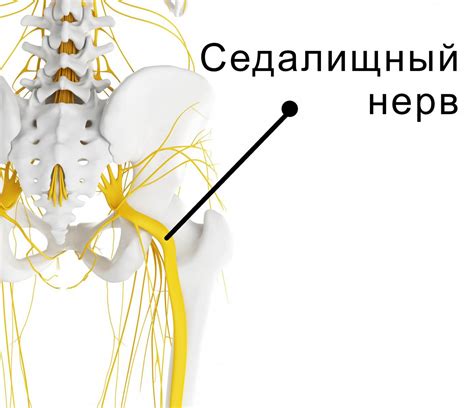 Частые факторы и механизмы патологического сдавления седалищного нерва