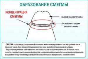 Что делать, если произошла диссоциация шва в области интимной зоны?