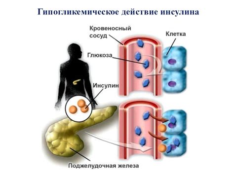 Что такое гипогликемическое действие инсулина?