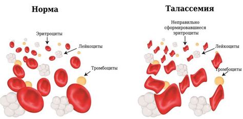 Что такое гипохромия выраженная?